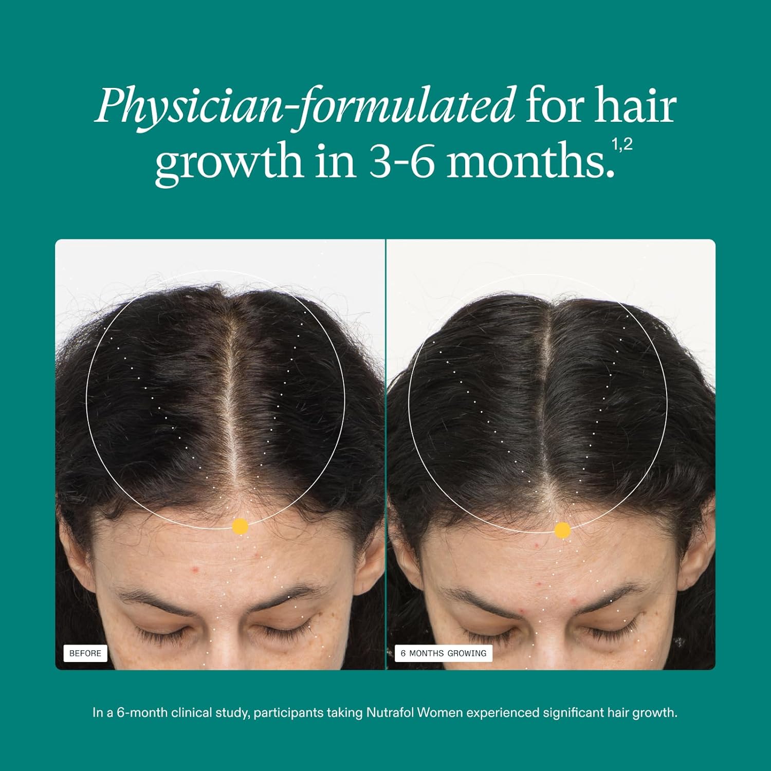 Nutrafol Women's Hair Growth Supplements, Dermatologist Recommended, Ages 18-44, Clinically Proven for Visibly Thicker and Stronger Hair - 2 Month Supply, Pack of 2 - Image 4