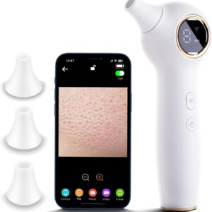 Blackhead Extractor with Camera, Black Head Remover for Face,Pore Extractor for Black Head and Acen, Blackhead Remover Tools with USB Rechargeable, Blackhead Remover Vacuum (White)
