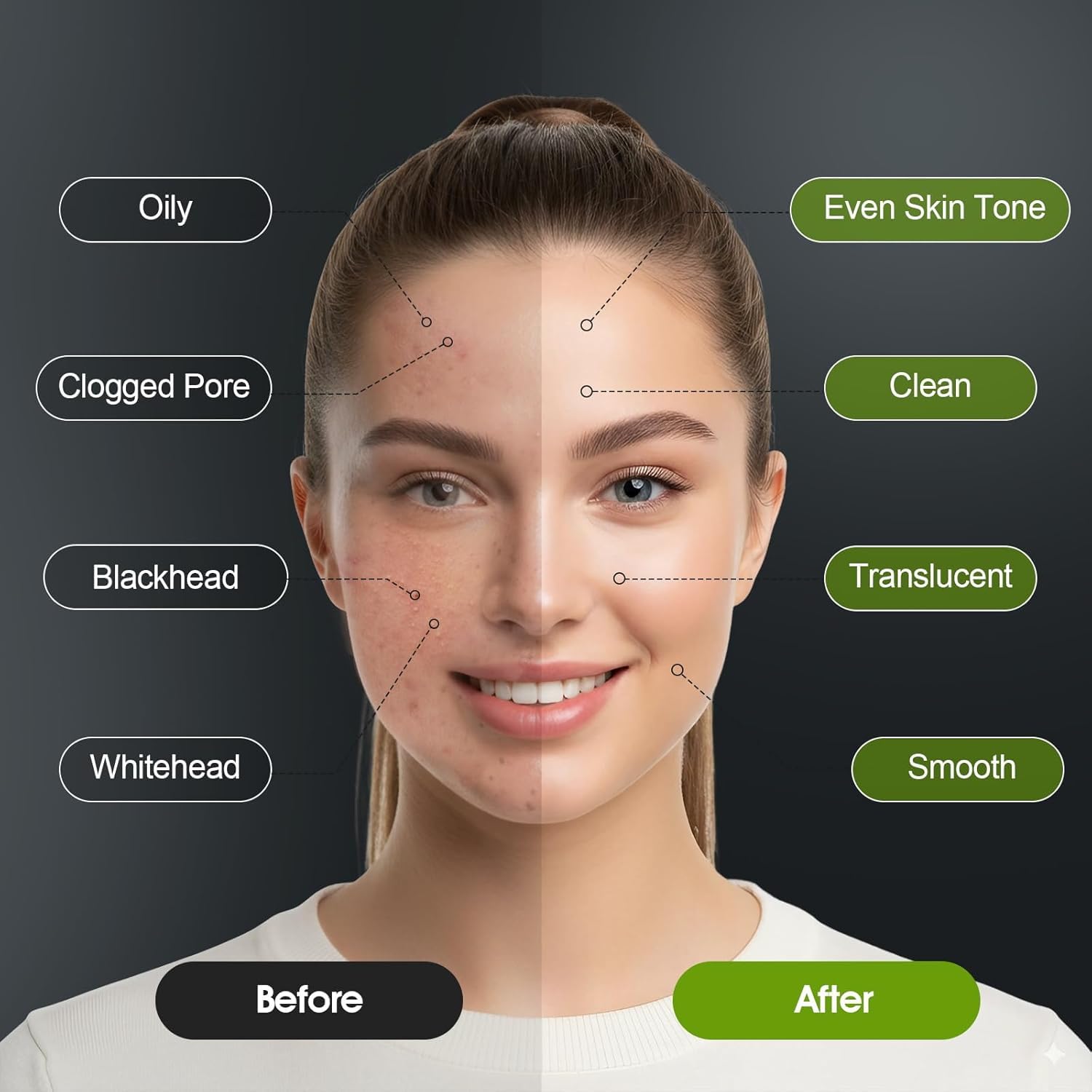Blackhead Remover Mask – Black Head Remover for Face & Nose, Deep Pore Cleansing, Reduces Blackheads & Excess Oil, Refines Pores for All Skin Types(2.8 Ounce (Pack of 1), Aloe Vera) - Image 2