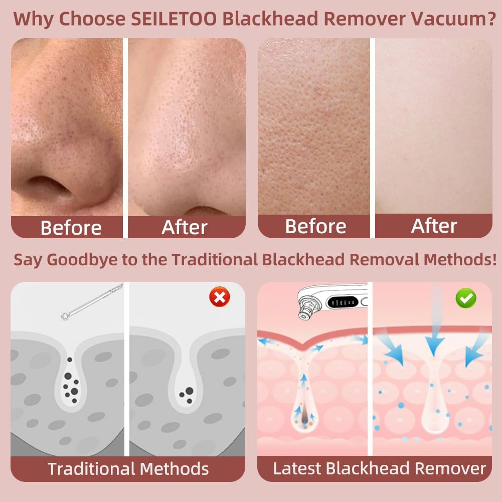 2026 Upgraded 5-Speed Blackhead Remover Vacuum, Type-C Rechargeable Blackhead Extractor with 4 Removable Heads, Black Head Extractor Tool for Women and Men, White Heads Removal for Face & Nose - Image 2