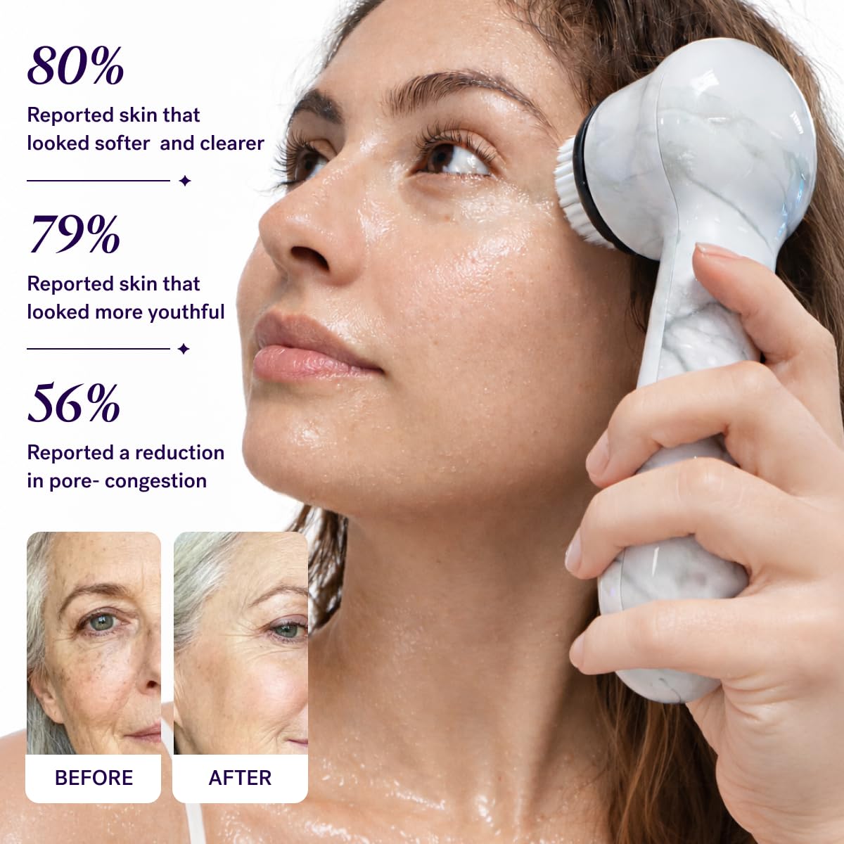 Michael Todd Beauty Soniclear Allure 2024 Best of Beauty Winner Facial Cleansing + Exfoliation Brush System with Antimicrobial Protected Bristles, 4 speeds, Serum Infusion Head + Travel Case - Image 5