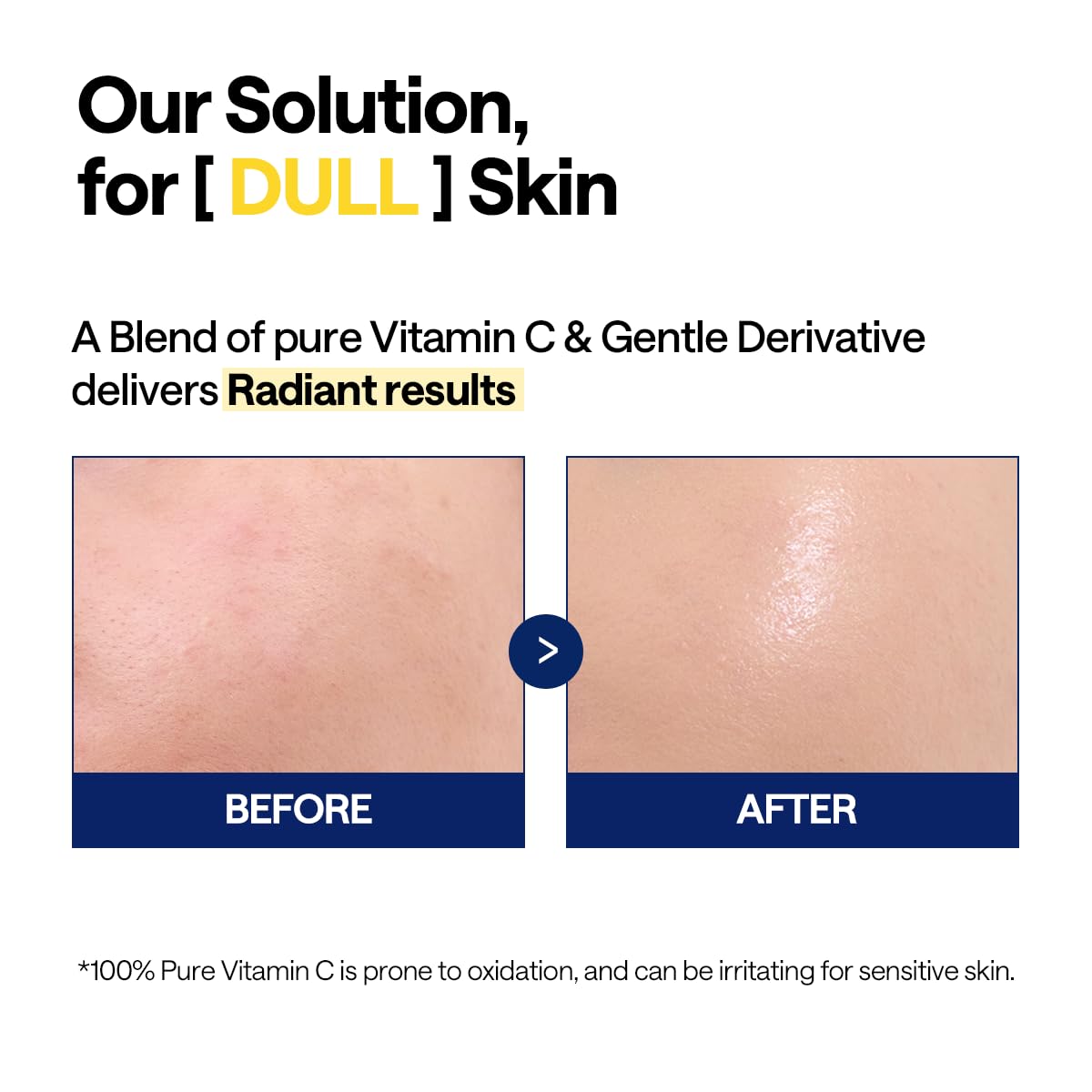 MEDIHEAL Vitamin C Brightening Serum (1.35 fl oz, 1 Pack) - Tone-Texture-Glow Care, Manage Skin with Vitamin C, Niacinamide, Hyaluronic Acid - Image 6
