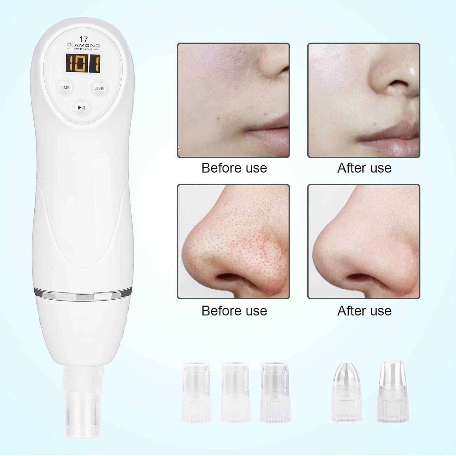 Diamond Microdermabrasion Machine Professional Blackhead Remover Vacuum Upgraded Facial Pore Cleaner Electric USB with 8 Probes Blackhead Remover Skincare Tool - Image 5