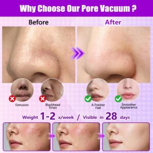 Blackhead Remover Vacuum with Heating, Pore Vacuum 3 Suction Levels, 5 Suction Heads, 9 Pattern,Pore Extractor with Pimple Popper Tool for Women & Men,for Nose,T-Zone, Chin Face Deep Pore Cleansing