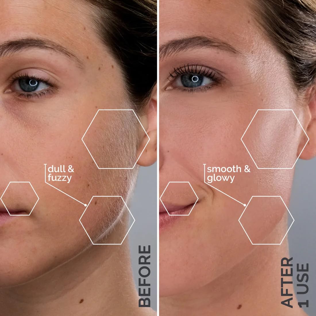 Michael Todd Beauty Sonicsmooth Pro+ Dermaplane Razor Blade Refills - 8 Dermaplaning Blades - 2 Month Supply - Device Not Included - Image 3