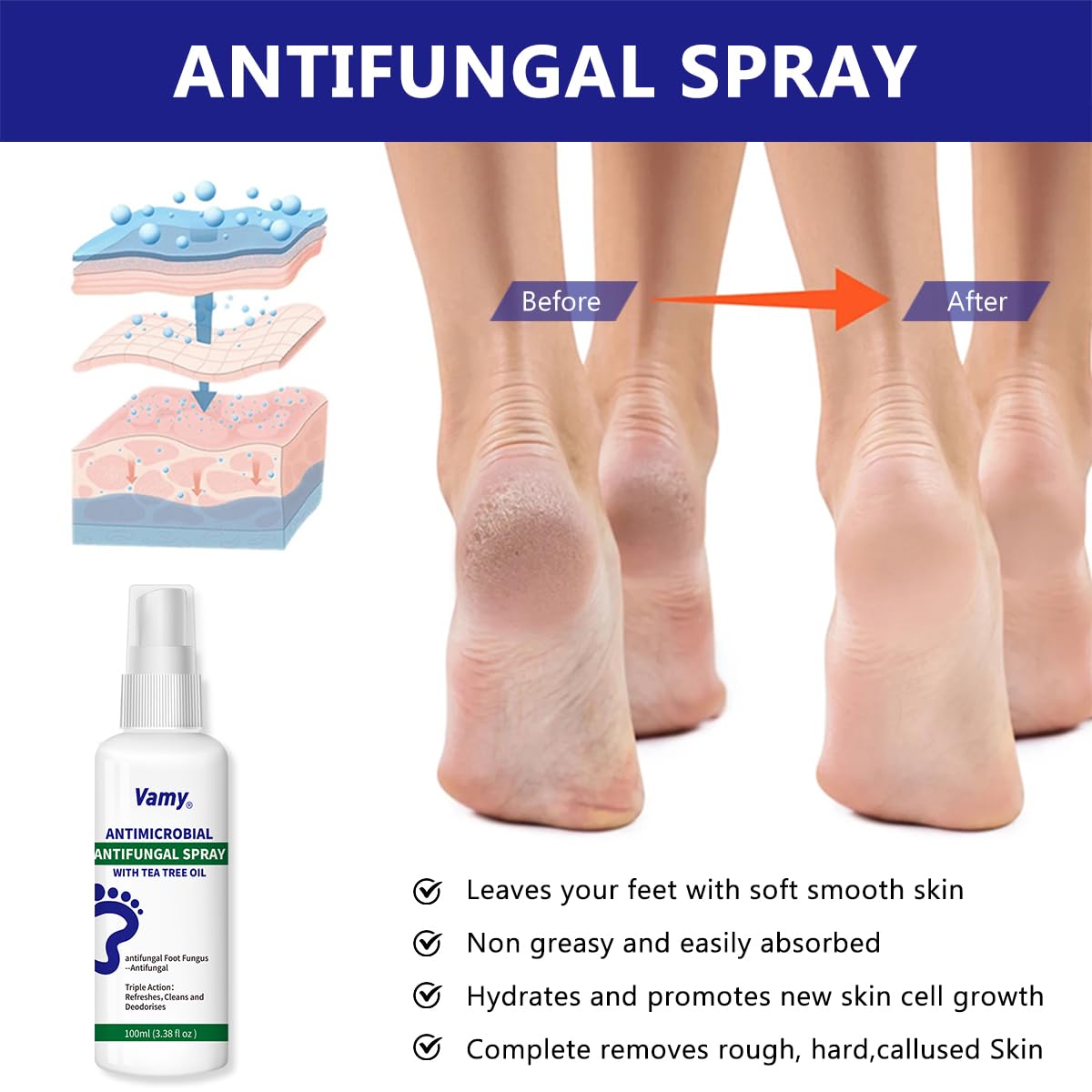 Vamy Complete Foot & Nail Kit Includes the Clinically Published Nail Solution and Foot Sanitizer Spray with Tea Tree Oil 3.38oz (2 ct)