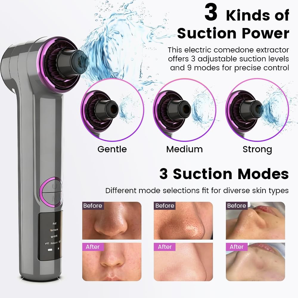 Blackhead Remover Pore Vacuum with Heating Function, Electric Comedone Extractor with 3 Suction Levels & 9 Modes, for Deep Pore Cleansing on Nose and Face with 5 Interchangeable Heads - Image 4