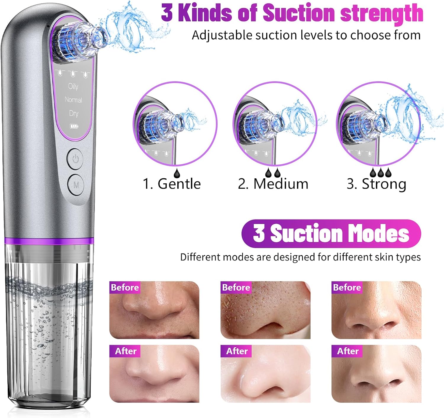 Blackhead Remover Suction Pore Vacuum Hydro Facials Hydrating Pore Cleaner Machine Pimple Extractor with USB Charging Cable Beauty Device - Image 2