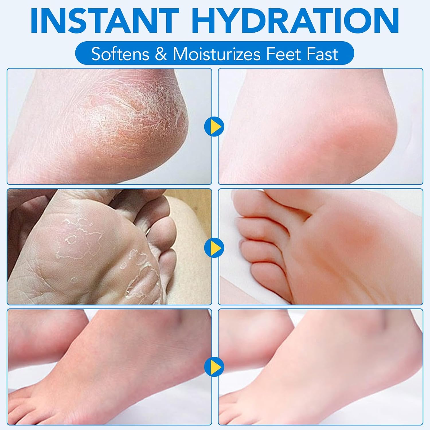 Uruses 3Pack Urea Cream 60% plus Salicylic Acid 2% Urea Foot Care Stick,Foot Cream for Foot Callus Remover, Feet Moisturizer Stick for Dry Cracked Heels, Hands, Knees,Hydrating Heel Balm, Easy To Use - Image 6