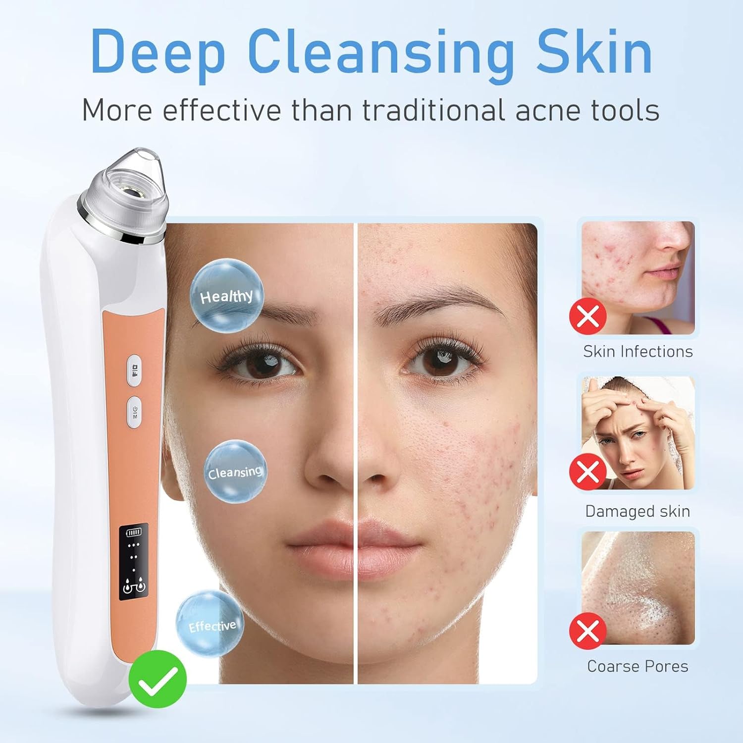 Facial Pore Blackhead Remover Vacuum, 1080P Camera Blackhead Remover, 20x Zoom, 8 LEDs & 3 Suction Modes, 800mAh Battery & USB - 6 Heads Pore Cleaner Kit for Women&Men(Orange) - Image 4