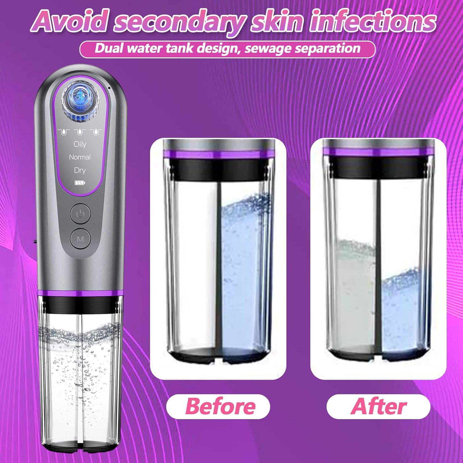 Blackhead Remover Suction Pore with Pore Vacuum Blackhead Remover Kit,5 Suction Heads & USB Charging Cable,Pimple Extractor,Pore Cleaner Machine for Facial Pore Cleansing for Women & Men - Image 5