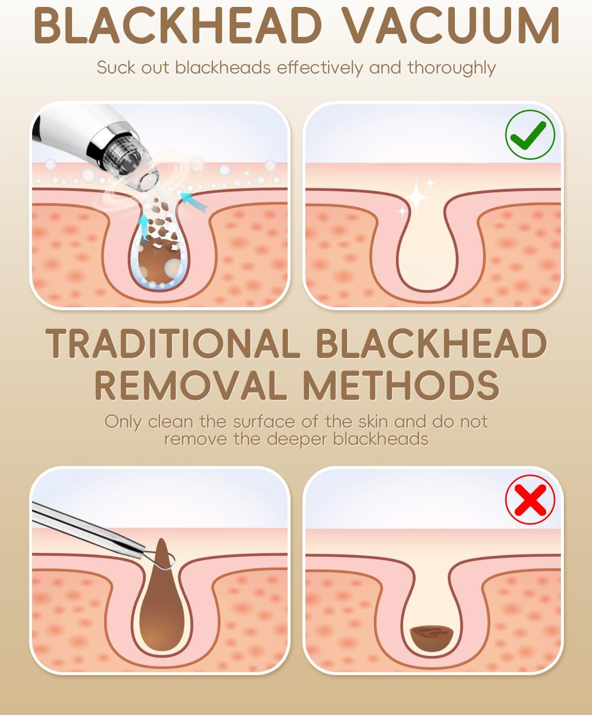 Rechargeable Blackhead Vacuum Pore Cleaner - 5 Attachments & 3 Suction Levels for Deep Facial Cleansing, USB-Powered Blackhead Remover for Women and Men (White) - Image 5