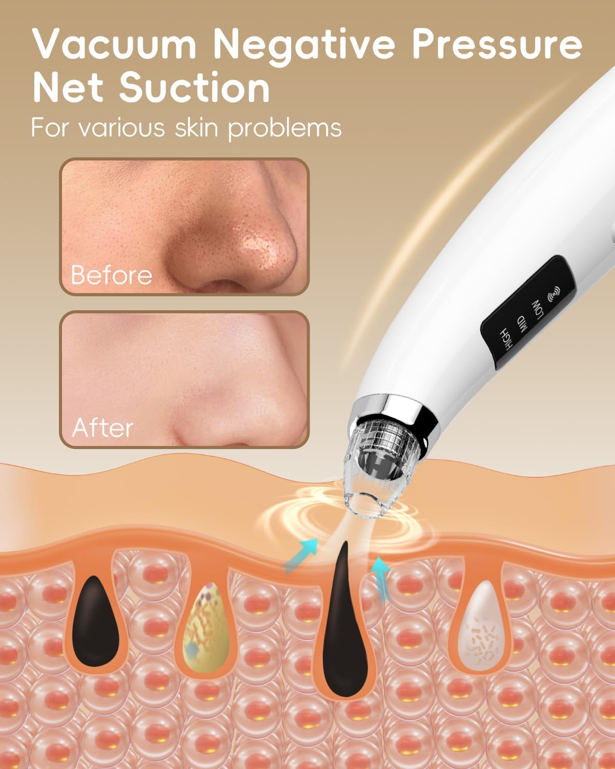 Rechargeable Blackhead Vacuum Pore Cleaner - 5 Attachments & 3 Suction Levels for Deep Facial Cleansing, USB-Powered Blackhead Remover for Women and Men (White) - Image 3