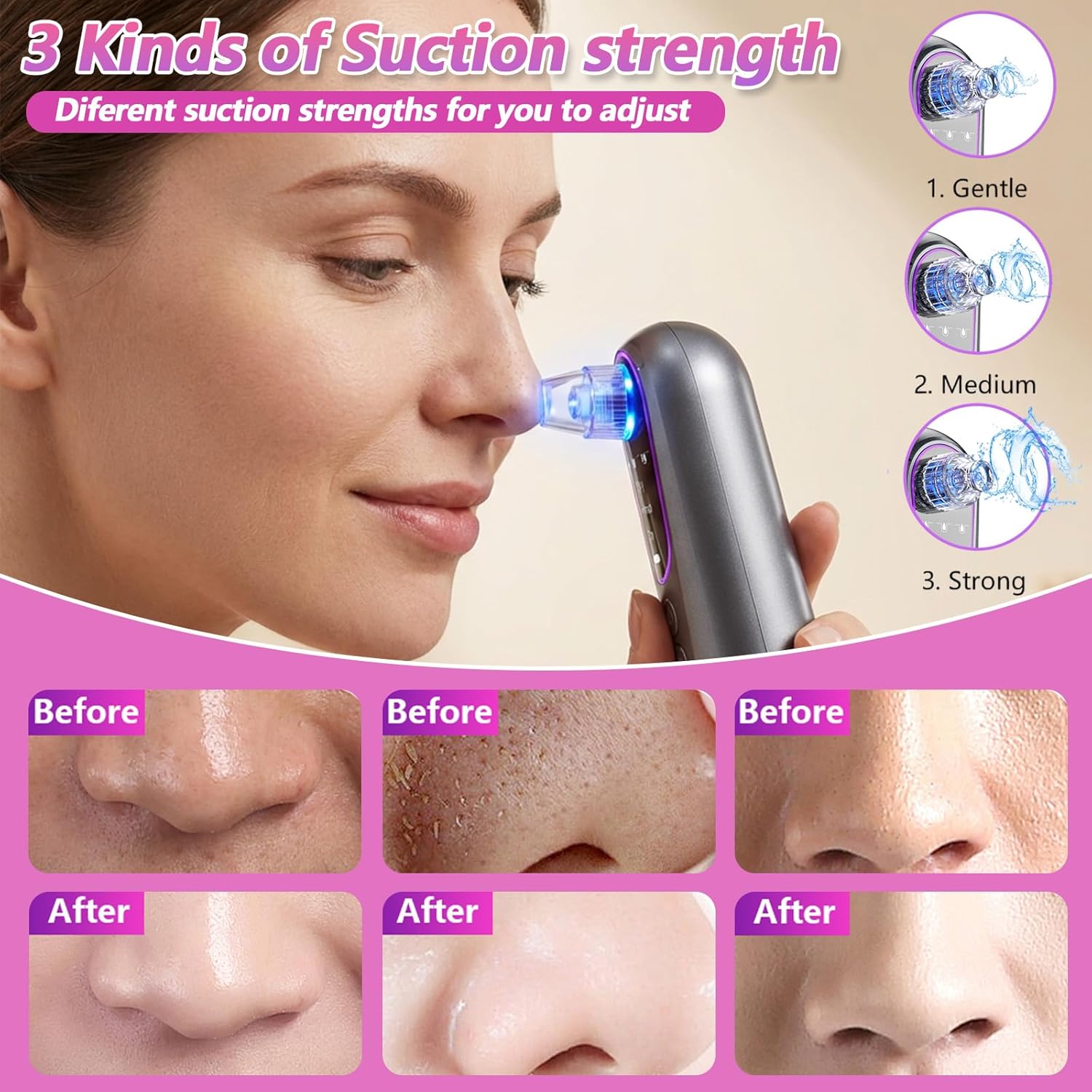 Blackhead Remover Suction Pore with Pore Vacuum Blackhead Remover Kit,5 Suction Heads & USB Charging Cable,Pimple Extractor,Pore Cleaner Machine for Facial Pore Cleansing for Women & Men - Image 4