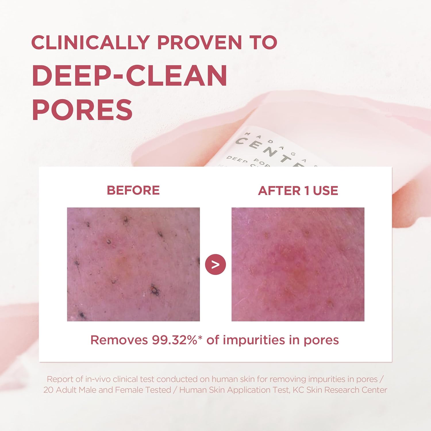 SKIN1004 Poremizing Deep Cleansing Foam, 4.23 fl.oz, 125ml, Makeup Remover, Korean Face Cleanser with Himalayan Pink Salt & Madagascar Centella Asiatica for Facial Pore Cleansing, Korean Skin Care - Image 3
