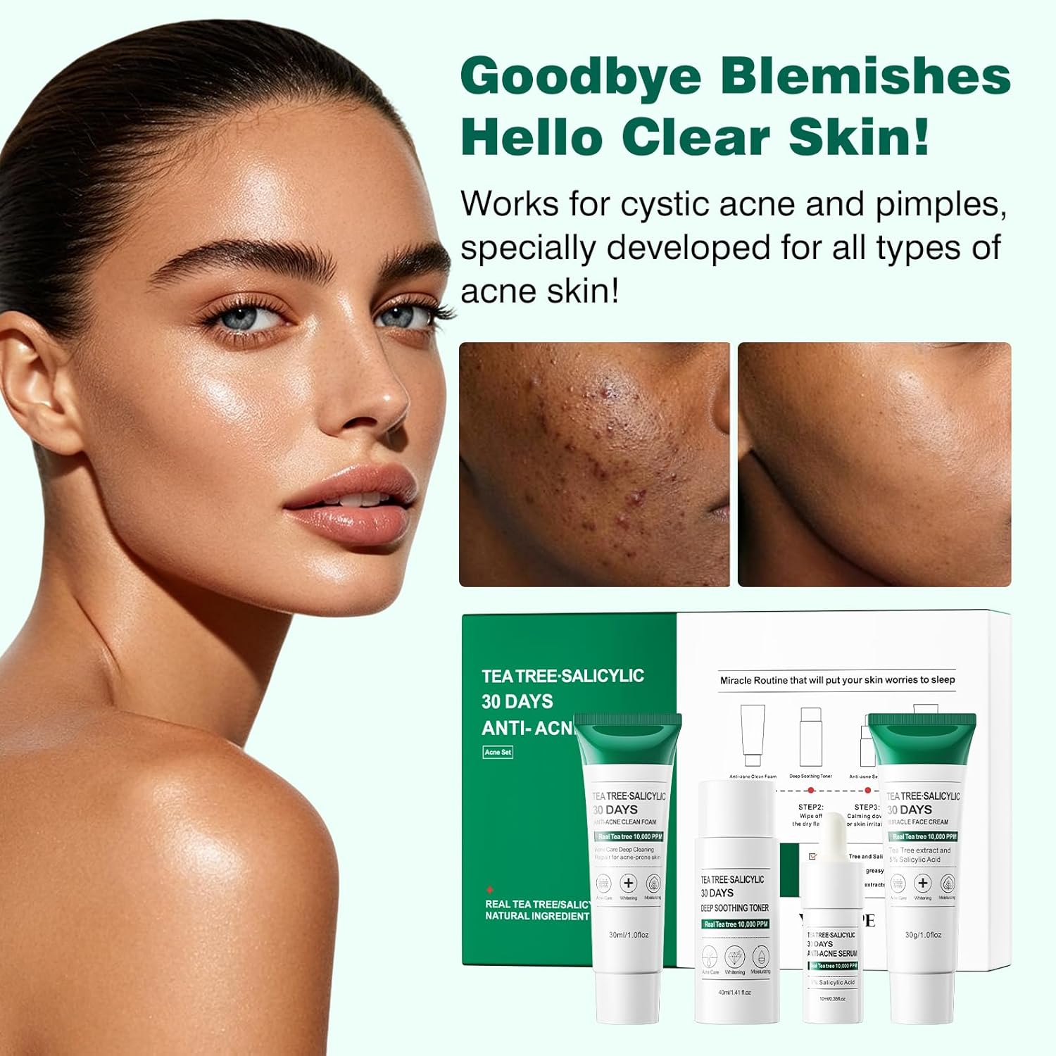 Tea Tree Salicylic Acid Facial Skin Care Set & kits, Mini Travel Size Set for Acne Prone Skin - Cystic Hormonal Acne Treatment with Face Cleanser Toner Serum Cream Moisturizer Gifts for Women - Image 3
