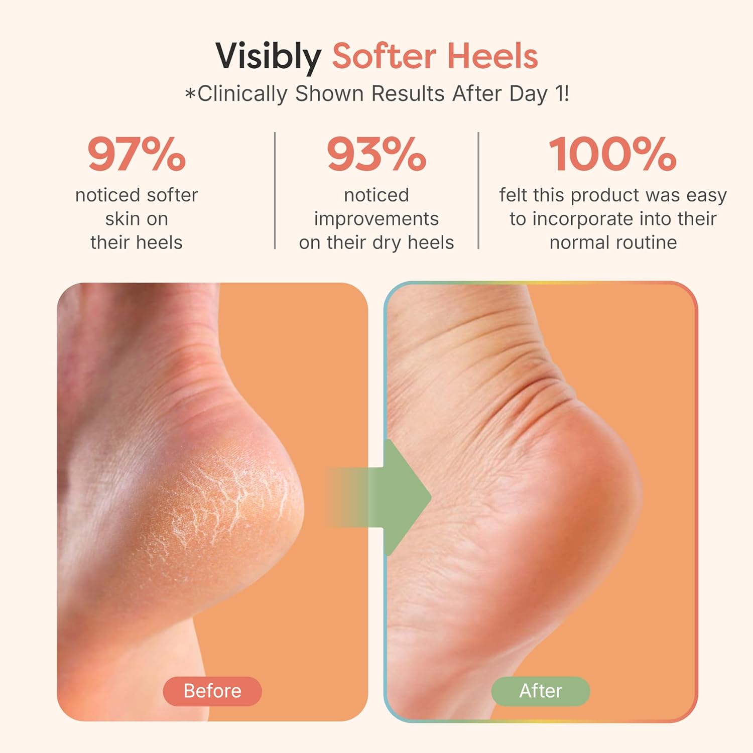 ZenToes Moisturizing Socks for Cracked Heel Treatment, Vitamin E, Olive Oil and Jojoba Oil Infused Heel Socks, Spa Gifts for Women, Mothers Day Gifts (Fuzzy Pink, Regular) - Image 3
