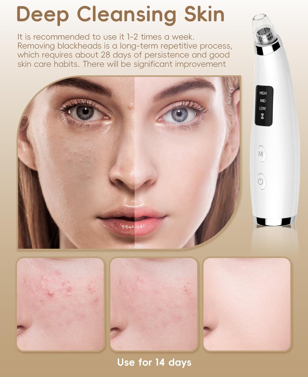 Rechargeable Blackhead Vacuum Pore Cleaner - 5 Attachments & 3 Suction Levels for Deep Facial Cleansing, USB-Powered Blackhead Remover for Women and Men (White) - Image 4