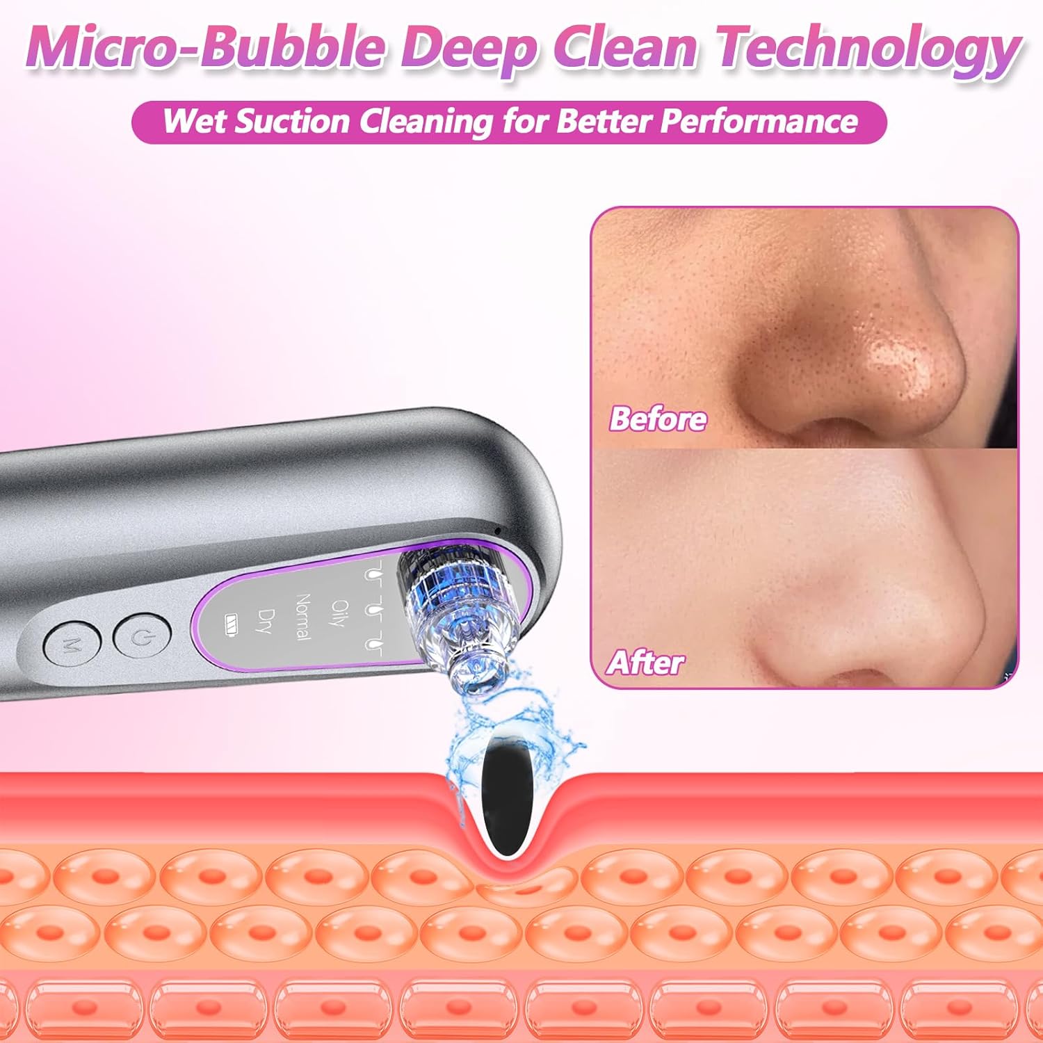 Blackhead Remover Suction Pore with Pore Vacuum Blackhead Remover Kit,5 Suction Heads & USB Charging Cable,Pimple Extractor,Pore Cleaner Machine for Facial Pore Cleansing for Women & Men - Image 3