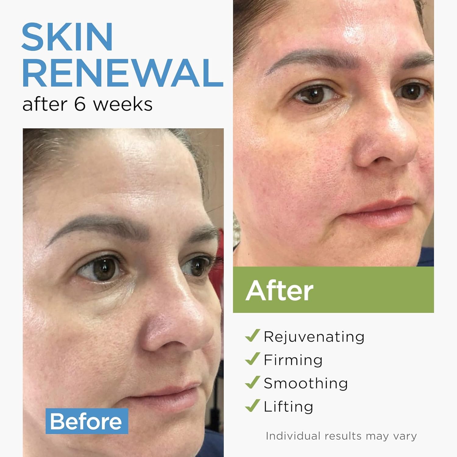 Moisturizer Collagen Anti-Aging Face Cream with Stem Cells, Retinol, Hyaluronic Acid & Niacinamide - Hydrating Day & Night Wrinkle Cream for All Skin Types - Airless Pump - Made in USA - 1.7Oz - Image 2