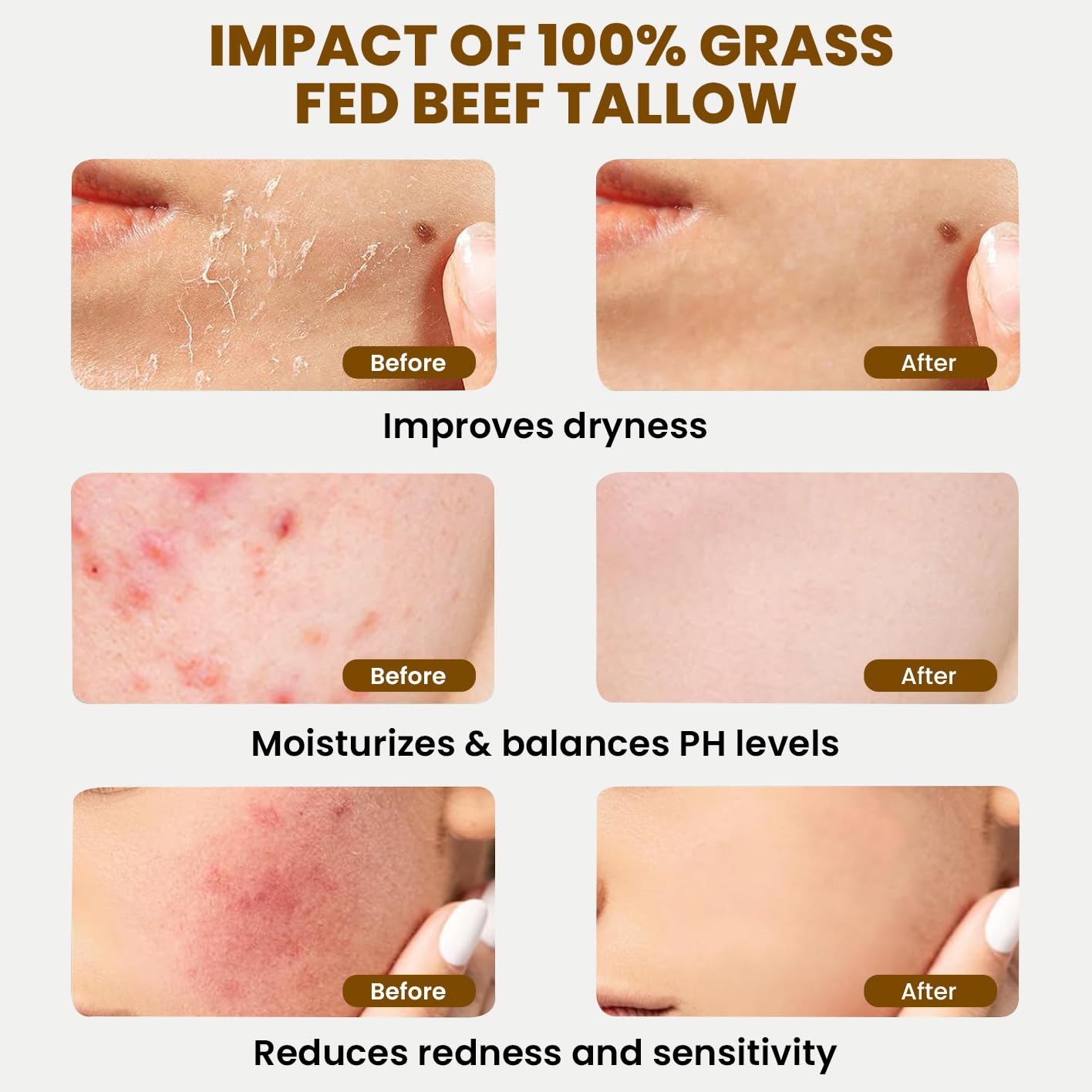 MONIER Whipped Beef Tallow for Skin, Tallow and Honey Balm for Face, Moisturizer with 100% Organic Grass-Fed Beef Tallow & Raw Wild Honey - Packaging May Vary - Dry & Sensitive Skin (Unscented) - Image 2