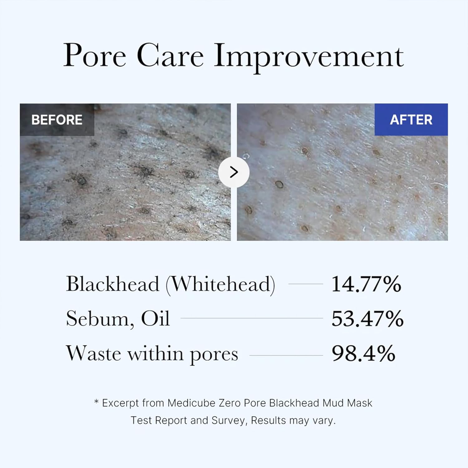 Medicube Zero Pore Blackhead Mud Facial Mask - Skin Cooling & Pore Tightening - 3 Minute Quick Dry Formula with AHA, BHA, PHA, and Pore-Purifying Clay - Korean Mud Mask 3.52 oz - Image 5