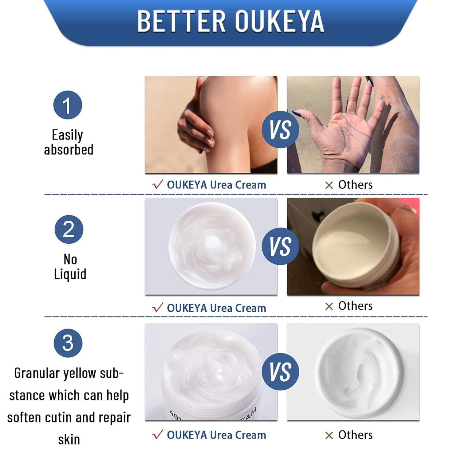 OUKEYA Urea Cream 40 Percent,Foot & Hand Cream for Dry Cracked,Urea Lotion for Feet Maximum Strength - Image 6