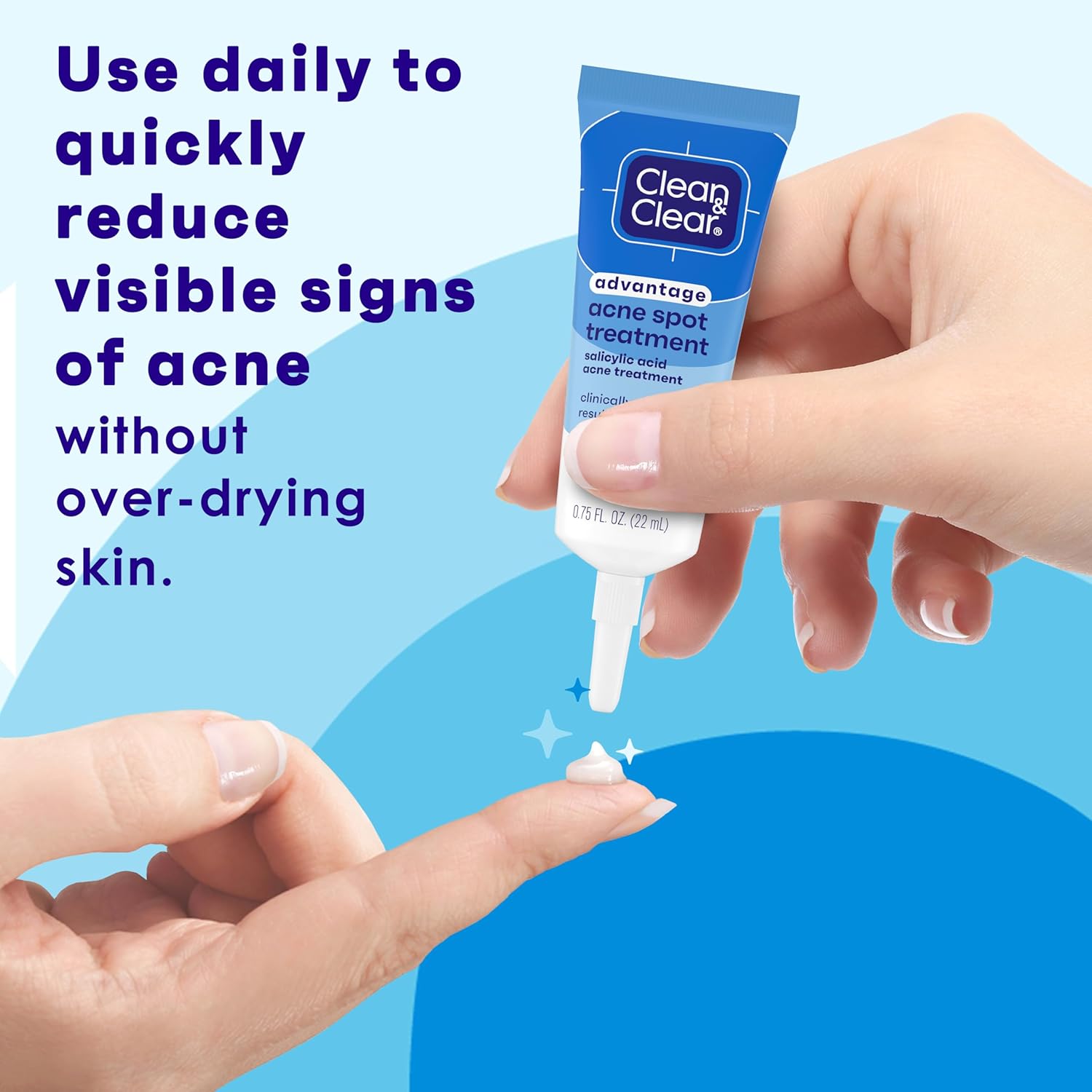 Clean and Clear Advantage Acne Spot Treatment Gel Cream with 2% Salicylic Acid & Witch Hazel, Acne Pimple Medication for Blemish & Blackhead Removal, Fragrance Free, 0.75 fl. oz - Image 2