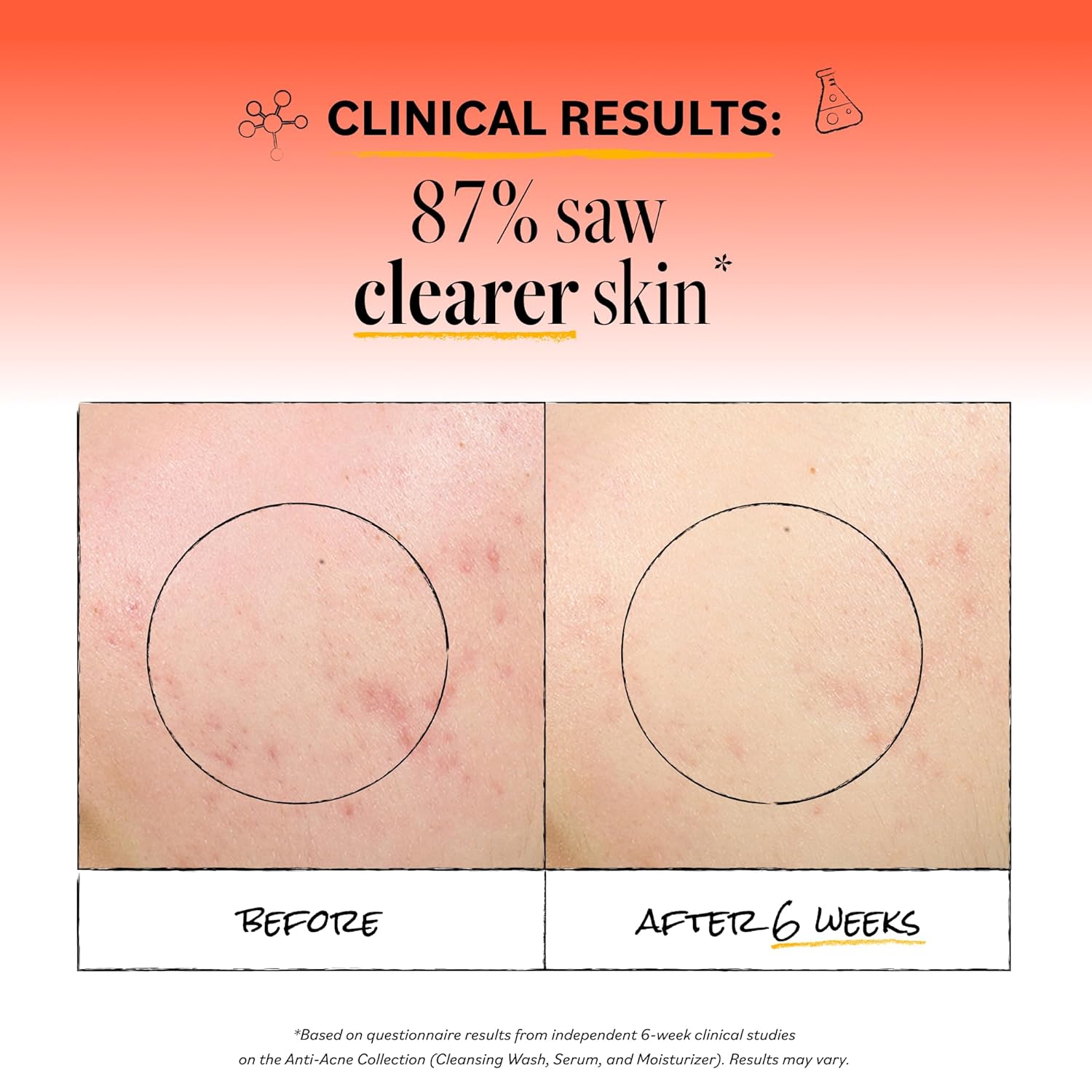 Derma E Acne Deep Pore Cleansing Wash – Blemish Control Facial Cleanser with Salicylic Acid - Gentle Oil Control Face Wash Soothes and Balances Skin, 6 fl oz - Image 3