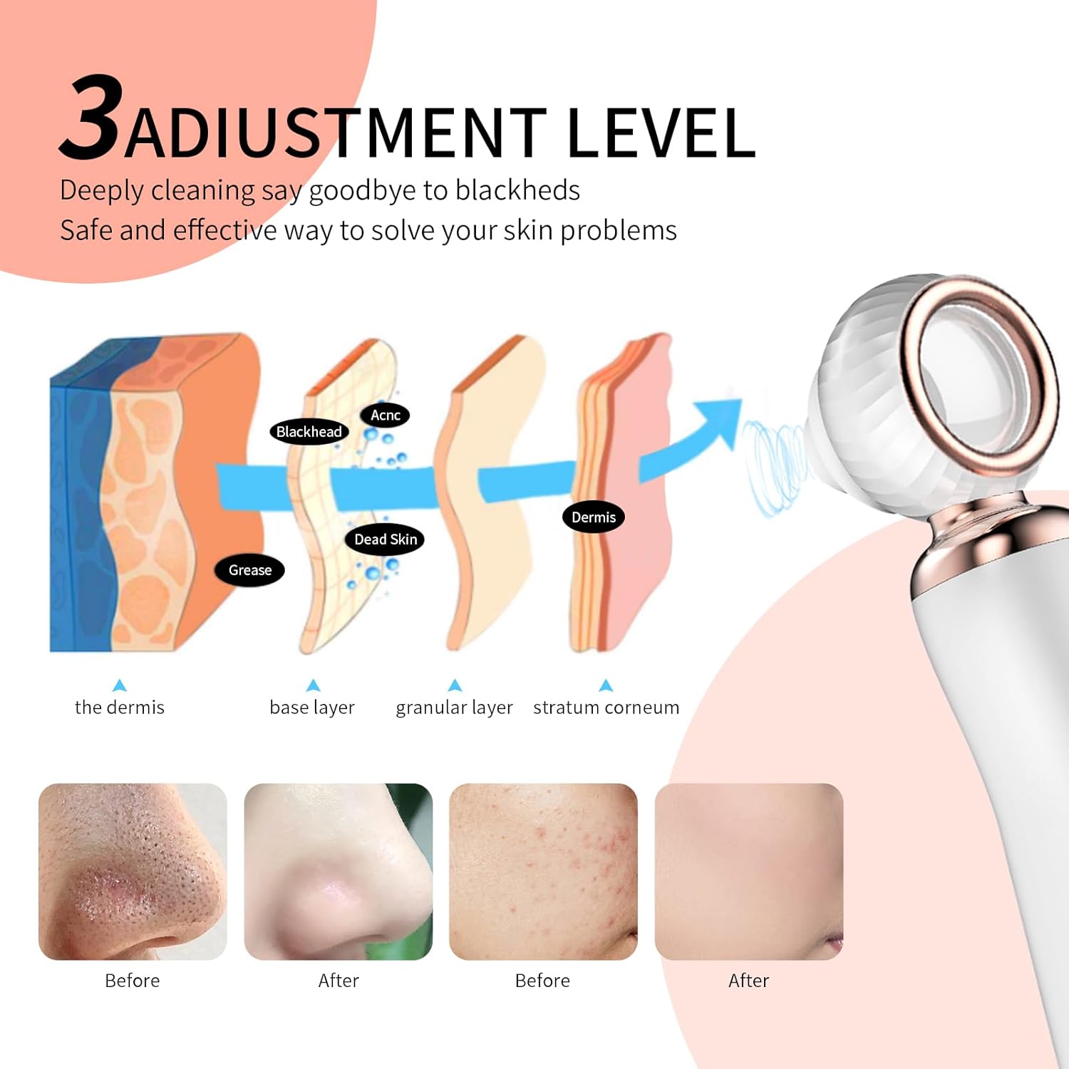 2025 Blackhead Remover Pore Vacuum, Visual Rechargeable Blackhead Vacuum Facial Pore Cleaner-3 Suction Soft Silicone,3 Probes,USB Kit Electric Acne Extractor Tool for Adult - Image 4