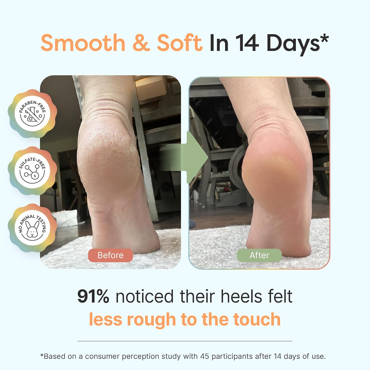 ZenToes Urea Cream 40 Percent for Feet | Foot Lotion for Dry Cracked Heels and Feet | Intense Dry Feet Softening and Hydration for Skin | Heel Balm and Moisturizing Care | 5oz - Image 2