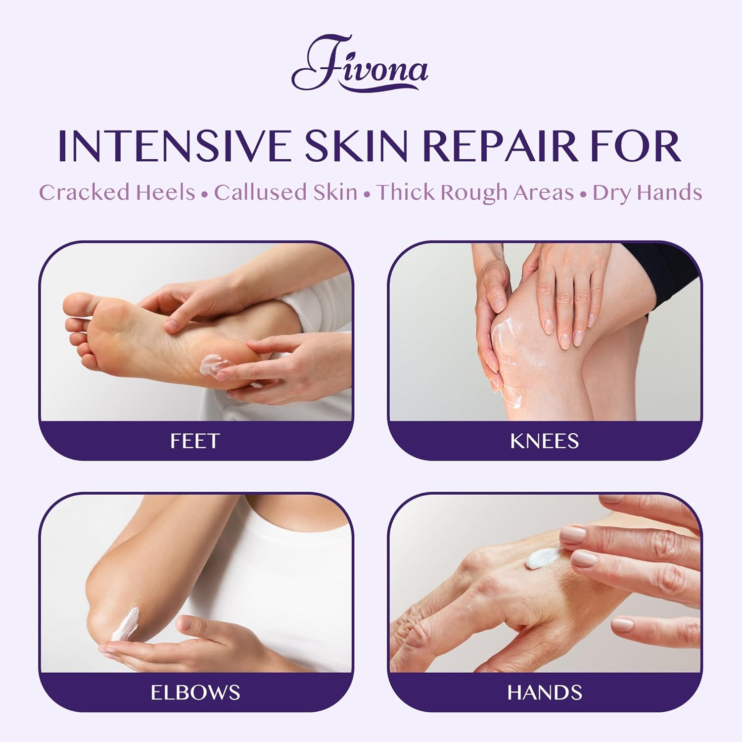 FIVONA 40% Urea Foot Cream for Dry Cracked Heels - Extra Strength Callus Softening Cream with 2% Salicylic Acid, Tea Tree & Lavender, 100g (3.5 oz) - Image 4