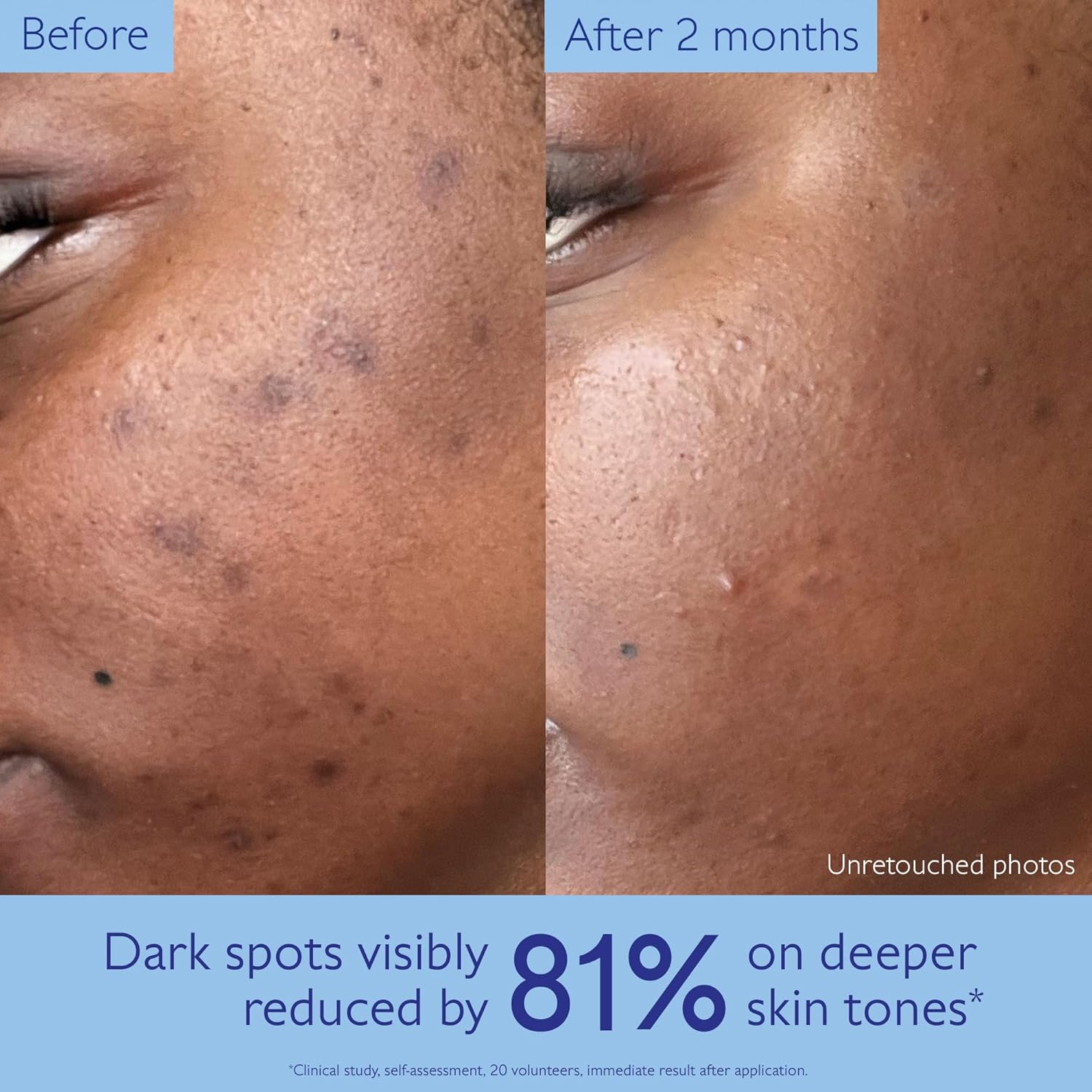 Caudalie Vinoperfect Brightening Dark Spot Serum Vitamin C Alternative - 62x More Effective than Vitamin C with Viniferine for a Visibly Brighter Even Complexion - Image 4