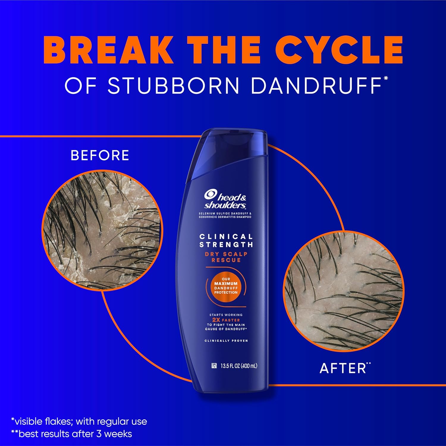 Head & Shoulders Anti-Dandruff Shampoo with 1% Selenium Sulfide, Clinical Strength Dry Scalp Rescue Shampoo Twin Pack, Seborrheic Dermatitis Relief, Dry Scalp 13.5 fl oz Each - Image 4