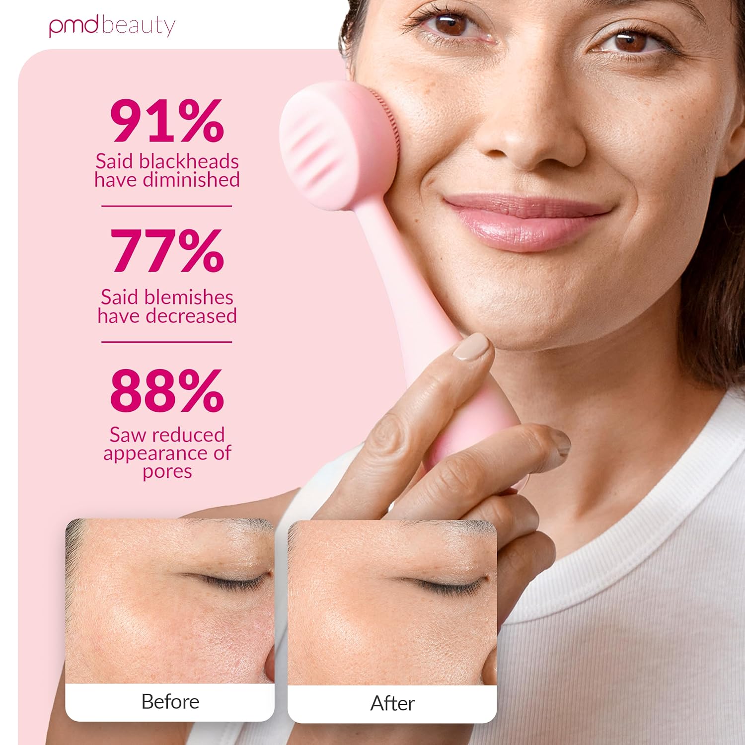 Clean, Acne, and Redvolution - Electric Facial Cleansing Brush, Smart Facial Device with Silicone Brush & Anti-Aging Massager, Red and Blue LED Light - Image 4
