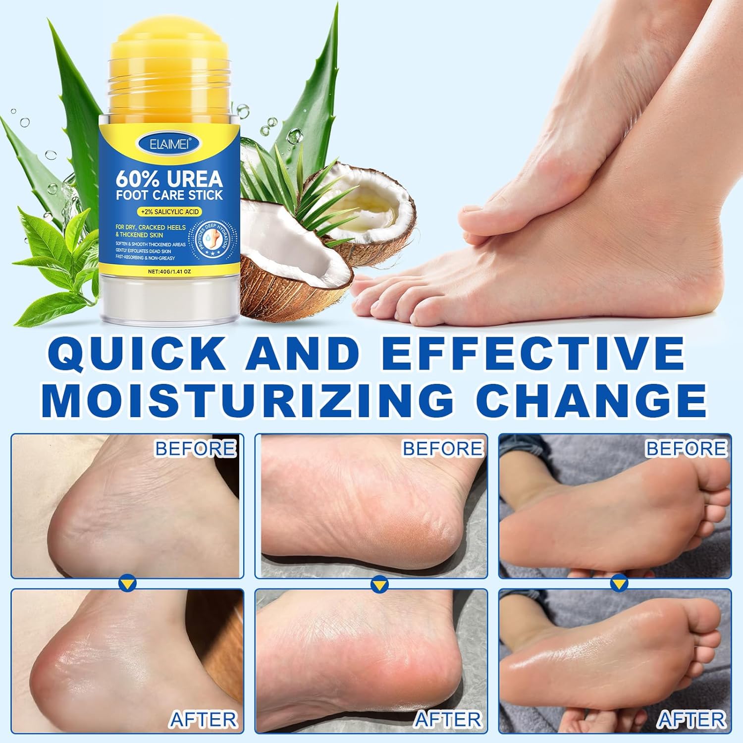Urea Foot Care Cream, Urea Cream 60 Percent for Feet Maximum Strength with 2% Salicylic Acid, Foot Cream for Cracked Heels and Dry Skin, Cracked Heel Repair, Callus Remover, Deep Hydration, 1.41 Oz - Image 5