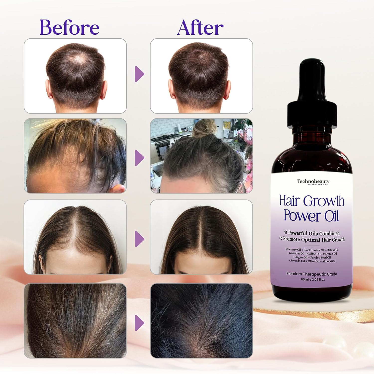 Rosemary Oil With Black Castor, Batana, Lavender, Coffee, Coconut, Argan, Avocado, Olive, Almond & Parsley Seed Oil, 11 Oils Infused for Ultimate Hair Growth & Care for Stronger, Thicker Hair - Image 3