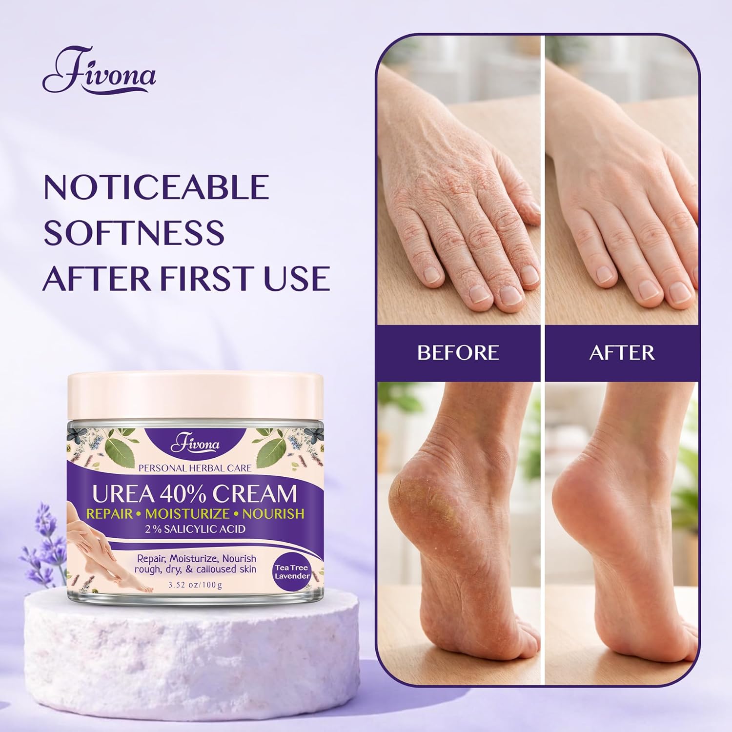 FIVONA 40% Urea Foot Cream for Dry Cracked Heels - Extra Strength Callus Softening Cream with 2% Salicylic Acid, Tea Tree & Lavender, 100g (3.5 oz) - Image 7