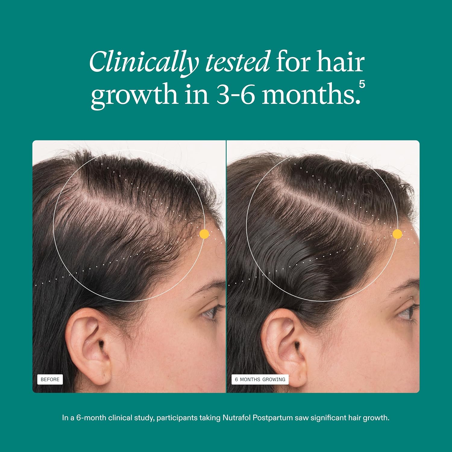 Nutrafol Postpartum Hair Growth Supplement - Image 4