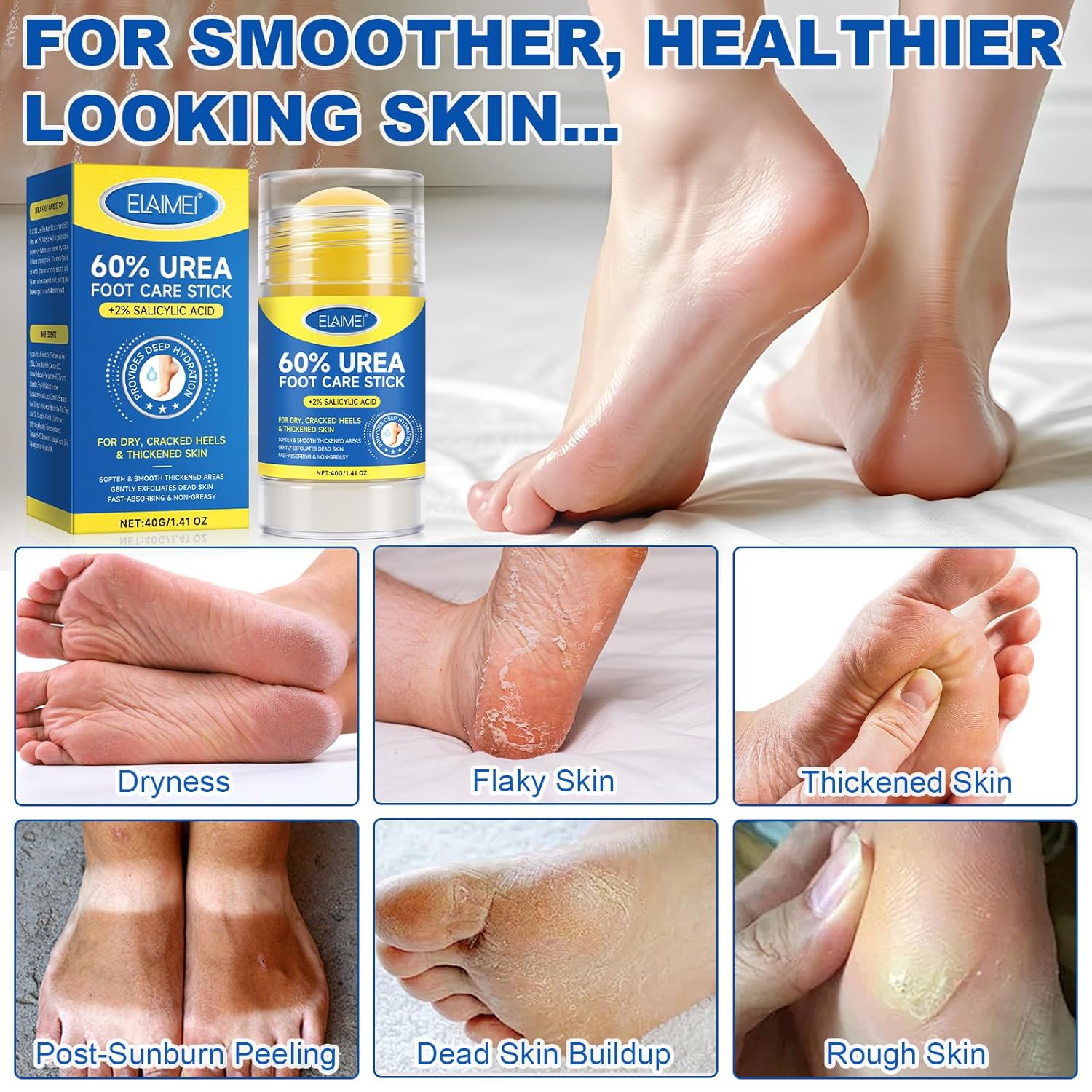Urea Foot Care Cream, Urea Cream 60 Percent for Feet Maximum Strength with 2% Salicylic Acid, Foot Cream for Cracked Heels and Dry Skin, Cracked Heel Repair, Callus Remover, Deep Hydration, 1.41 Oz - Image 3