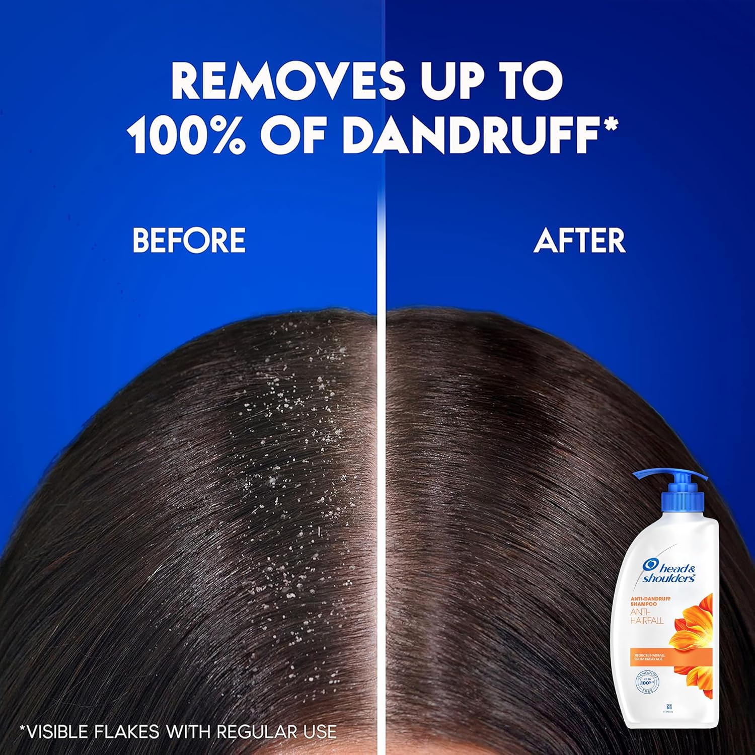 Head & Shoulders Anti Hair fall Shampoo, 2 Pack Anti Dandruff Shampoo, Relieves Dry Scalp and Repairs Damage, Fresh Scent, 22 oz Pump Bottles - Image 8
