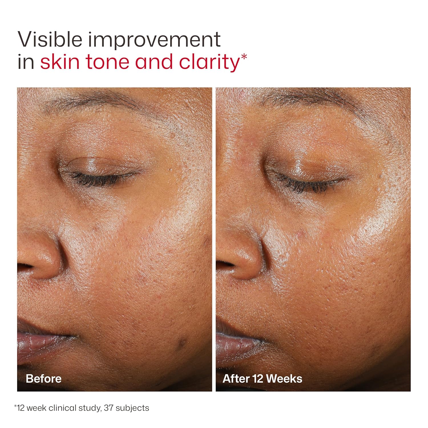 EltaMD UV Clear Face Sunscreen SPF, Oil-Free Sunscreen with Zinc Oxide, Dermatologist Recommended - Image 8