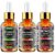 3 Pack Face Serum Set – Includes Vitamin C, Retinol & Hyaluronic Acid – Firming, Brightening & Hydrating – Reset Your Skin Day and Night